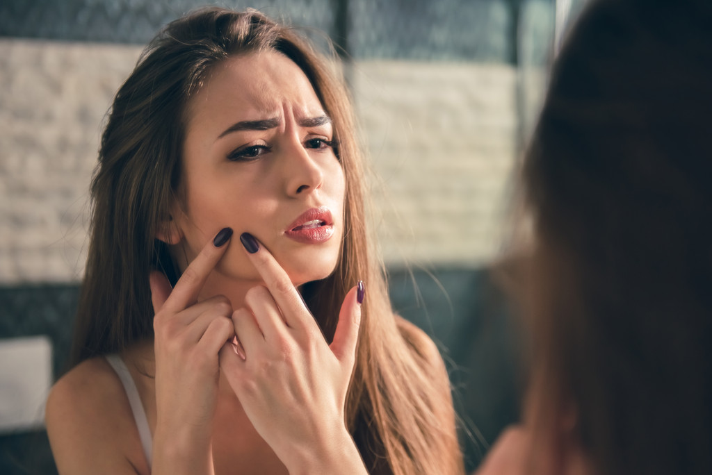 a woman with face acne